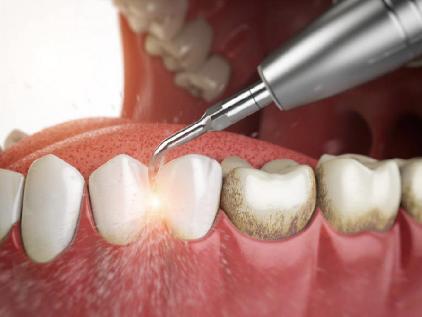 Современные способы чистки зубов и ротовой полости