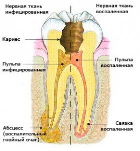Лечение зубов клиника Улыбка Самара