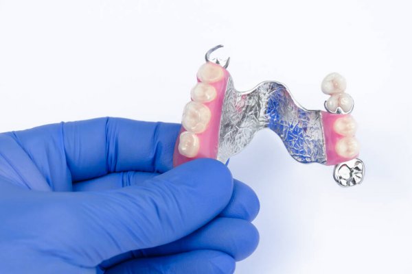 Съемное протезирование зубов клиника Улыбка Самара
